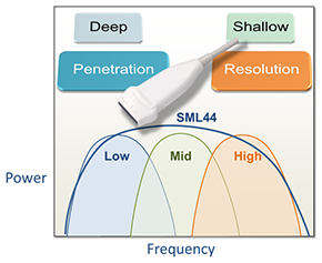 22MHZの超高解像度プローブーブ 22MHZの超高解像度プローブ